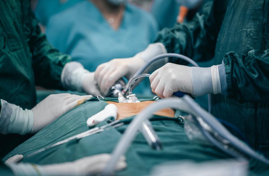 Endometriose laparoscopia