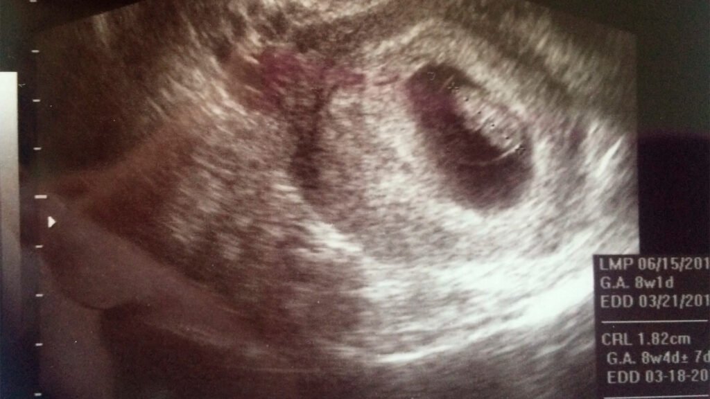 Gerar - 2º mês segundo mes