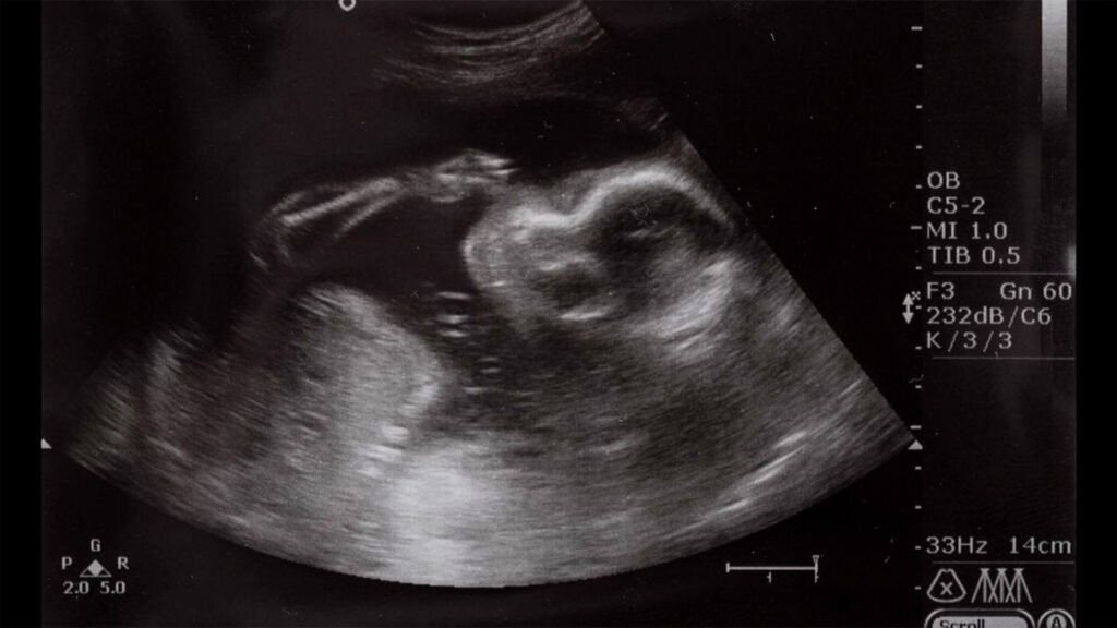 Gerar - 6º mês sextomes