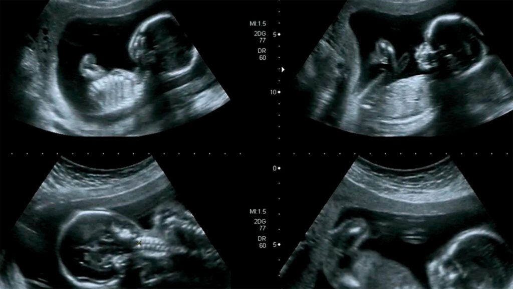 Gerar - 3º mês terceiro mes